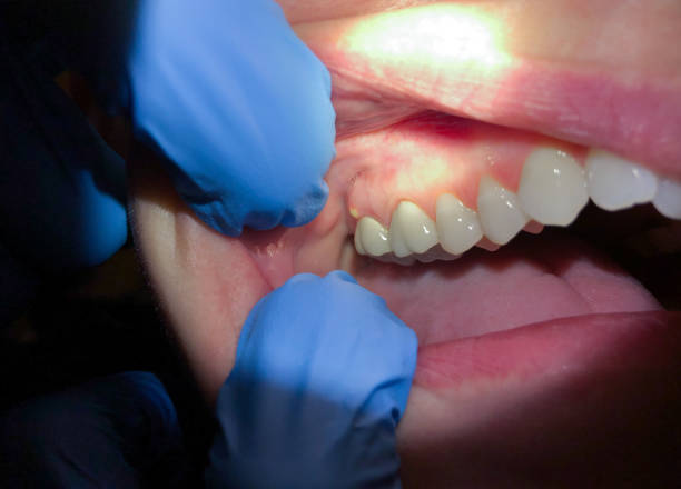 Best Urgent Care for Lost Fillings or Crowns in Little Canada, MN